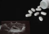 Ultrasound image and spilled white pills on black background
