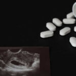 Ultrasound image and spilled white pills on black background