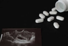 Ultrasound image and spilled white pills on black background