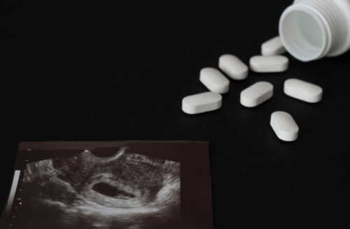 Ultrasound image and spilled white pills on black background