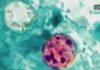 Two Dead—Records Locked Away Health Alert: 2 dead, 18K cases reported in cyclosporiasis outbreak