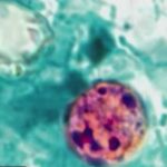 Two Dead—Records Locked Away Health Alert: 2 dead, 18K cases reported in cyclosporiasis outbreak