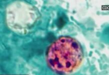 Two Dead—Records Locked Away Health Alert: 2 dead, 18K cases reported in cyclosporiasis outbreak