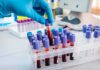 Gloved hand holding a blood sample tube in a lab rack