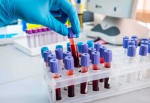 Gloved hand holding a blood sample tube in a lab rack
