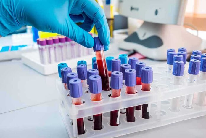 shutterstock_327930536 Gloved hand holding a blood sample tube in a lab rack